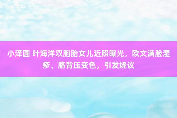 小泽圆 叶海洋双胞胎女儿近照曝光，欧文满脸湿疹、胳背压变色，引发烧议